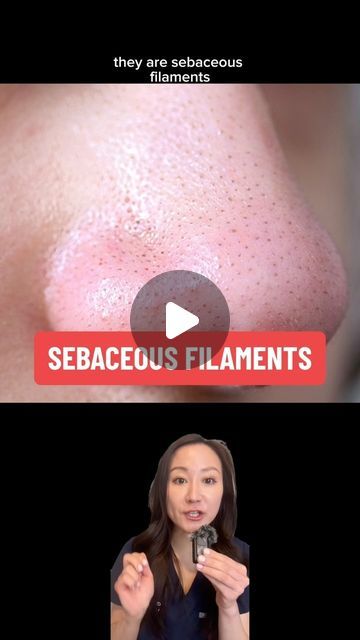 Jenny Liu, MD FAAD , Skincare expert on Instagram: "Sebaceous filaments like pores are normal part of skin. We all have them, and like pores they are necessary and we cannot completely remove them either. However there are ways you can improve their appearance and overall skin texture. Watch until the end for my tips 

Do you struggle with sebaceous filaments?

#sebaceousfilaments #cloggedpores #oilyskincare #skincaretips #derm" How To Get Rid Of Sebaceous Filaments, Sebaceous Filaments Removal, Sebum Removal, Sebaceous Filaments, Oily Skin Care, Clogged Pores, Skin Texture, Care Tips, Personal Growth