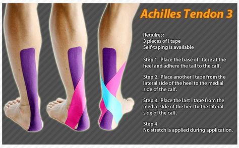 Kinesiology taping instructions for the achilles tendon #ktape #ares #achillestendon Achilles Pain, K Tape, Achilles Tendon, Kinesio Taping, Running Injuries, Sports Tape, Kinesiology Taping, Shin Splints, Heel Pain