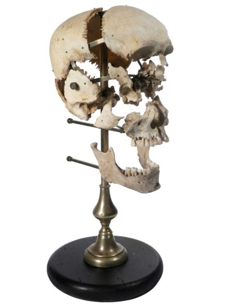 #skull #bones #deconstructed #model #diagram Tattoo About Healing, Exploding Skull, Anatomical Illustration, Teaching Displays, Skull Model, Skull Bones, Momento Mori, Medical Studies, Human Skull