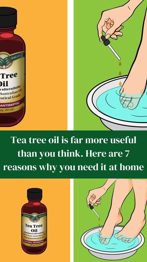 Tree Oil Benefits, Tee Tree Oil, Tea Tree Oil Benefits, Tea Tree Oil Uses, Tea Health Benefits, Tree Nails, Tee Tree, Tea Benefits, Oil Benefits