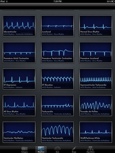 ACLS Rhythms Cheat Sheet | Welcome, Guest | Login | Register | Forgot Password |: Nursing Cheat, Nursing Information, Cardiac Nursing, Nursing School Survival, Critical Care Nursing, Nurse Rock, Nursing School Studying, Nursing School Tips, Nursing School Notes