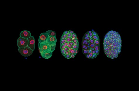 Stages of C. elegans (small round worm) development | 2017 Photomicrography Competition | Nikon’s Small World Southern Reach Trilogy, C Elegans, Bio Chemistry, Graffiti Graphic Design, Science Artwork, Nikon Small World, Microscopic Photography, Micro World, Graffiti Graphic