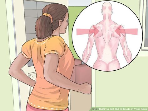 3 Ways to Get Rid of Knots in Your Back - wikiHow Muscle Knots In Back, Knots In Back, Muscle Knots, Muscle Abdominal, Lift Weights, Trigger Points, Back Muscles, Back Pain Relief, Back Exercises