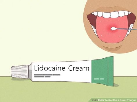 13 Ways to Soothe a Burnt Tongue - wikiHow Burnt Tongue Remedies, Burning Tongue, Burnt Tongue, Burn Remedy, White Tongue, Sjogrens Syndrome, Just My Luck, Numbing Cream, Plant Help