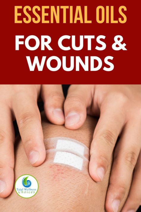 Essential Oil For Cuts, Natural Medicines, Diffuser Diy, Oils For Scars, Healthy Remedies, Essential Oils For Headaches, Healing Essential Oils, Essential Oils Guide, Oil Remedies