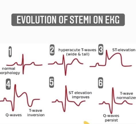 Cardiology Np, Cath Lab Nursing, Ekg Tech, Emt Study, Cardiac Sonography, Medical Terminology Study, Physician Assistant School, Ekg Interpretation, Flight Nurse