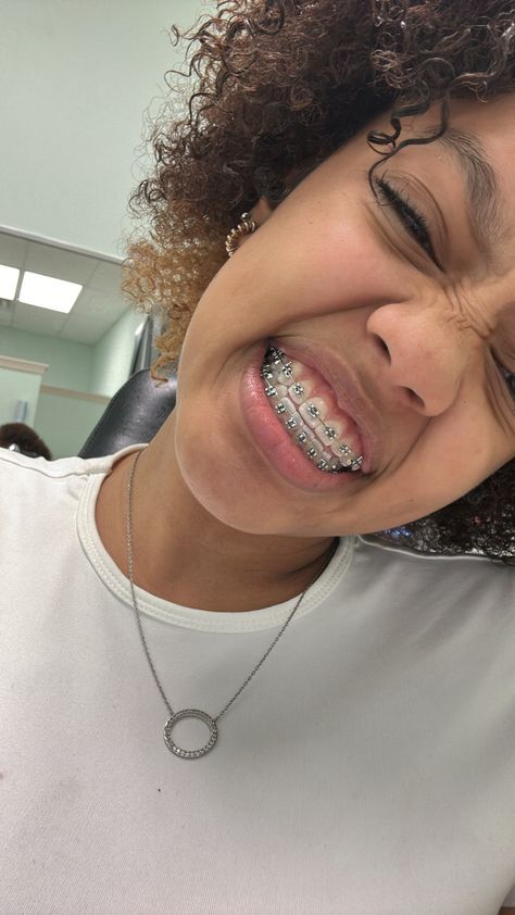 Dental Braces Colors, Braces Colors Combinations, Silver Braces, Pretty Backrounds, Cute Braces Colors, Pretty Teeth, Braces Tips, Getting Braces, Braces Girls