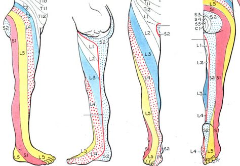 Shoulder Muscle Pain, Sciatic Nerve Relief, Cauda Equina, Shoulder Muscle, Disc Herniation, Bolesti Chrbta, Bulging Disc, Disk Herniation, Spinal Injury