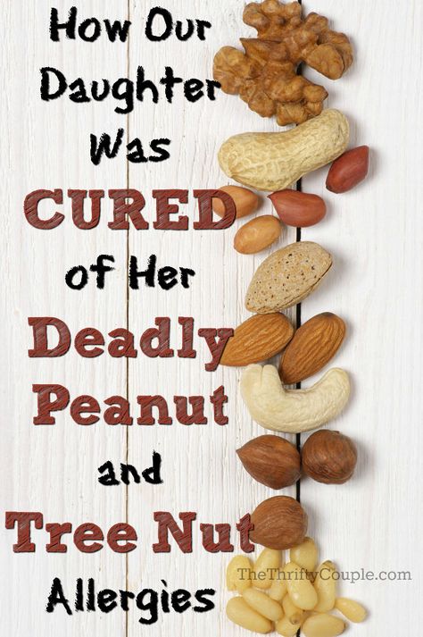 are seeds tree nuts - Google Search Cashew Allergy, Allergy Remedies For Kids, Epi Pen, Allergies Remedies, Food Allergy Awareness, Tree Nut Allergy, Food Allergies Awareness, Herbal Therapy, Egg Allergy