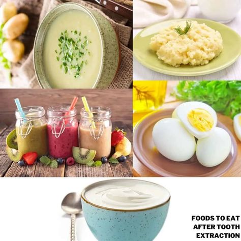 Meals To Eat After Wisdom Teeth Removal, Good To Eat After Wisdom Teeth, Soft Foods After Tooth Extraction, Foods To Eat After Tooth Extraction, What To Eat After Tooth Extraction, Tooth Extraction Aftercare Food, Soft Foods After Surgery Teeth, Wisdom Teeth Removal Food, Blended Soups