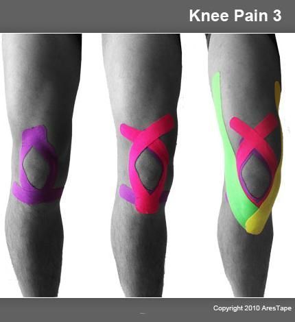 Knee Taping, Punkty Spustowe, How To Strengthen Knees, Kinesio Taping, Kinesiology Taping, Knee Exercises, Sports Injury, Knee Injury, Knee Pads