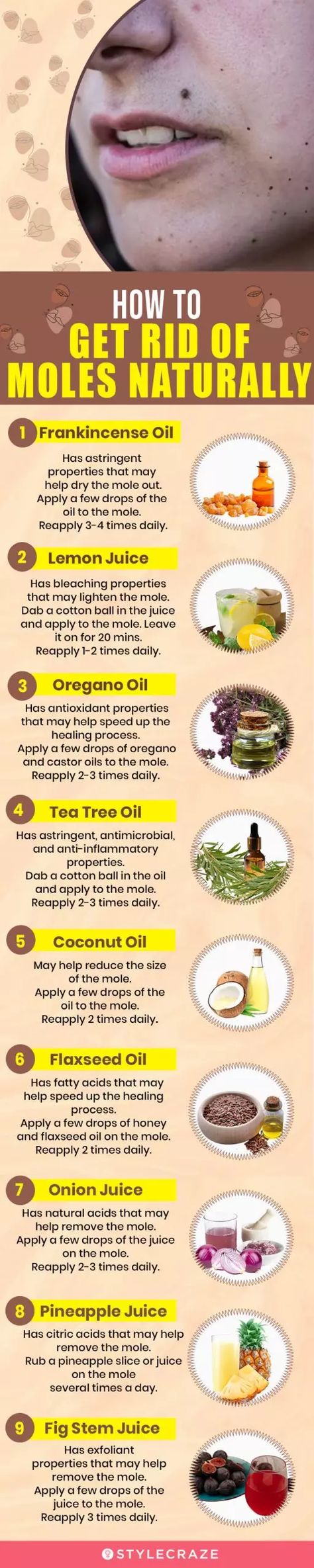 24 Effective Home Remedies For Mole Removal Removal Of Moles On Face, A Mole On The Face, How To Remove Moles From Face At Home, How To Remove Moles From Face, Mole Removal On Face, Mole Removal At Home, Remove Moles Naturally, Natural Mole Removal, How To Remove Moles