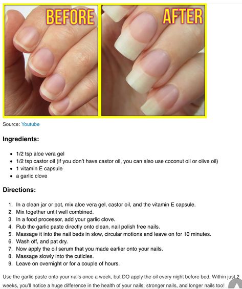 Strength Nails, Nail Growth Tips, Vitamin E Capsules, Make Up Foundation, Natural Nail Care, How To Grow Nails, Nail Growth, Growth Serum, Strong Nails