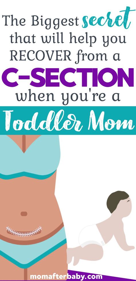 Post Cesarean Recovery, Postpartum With A Toddler, Cesarean Section Recovery, Post C Section Recovery, Prepare For C Section, Recovering From C Section, Belly Skin Tightening, Cesarean Recovery, Activities To Do With Toddlers