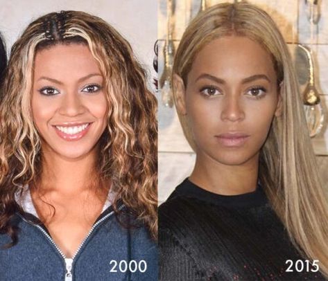 Beyonce Nose Job, Nose Plastic Surgery, Surgery Nose, Bad Celebrity Plastic Surgery, Bad Plastic Surgeries, Breast Image, Rhinoplasty Nose Jobs, Celebs Without Makeup, Nose Jobs