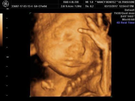 Boy Ultrasound, Fake Pregnancy, Vision 2024, Baby Ultrasound, Baby Scan, Baby Family, Ultrasound, Girly Photography, Drake