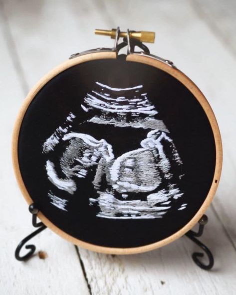 Ultrasound Embroidery by Yulia Sherbak Baby Ultrasound, Sound Picture, Modern Embroidery Kit, Embroidered Portrait, Ultrasound Pictures, Special Pictures, Hand Embroidery Projects, Thread Painting, Baby Projects