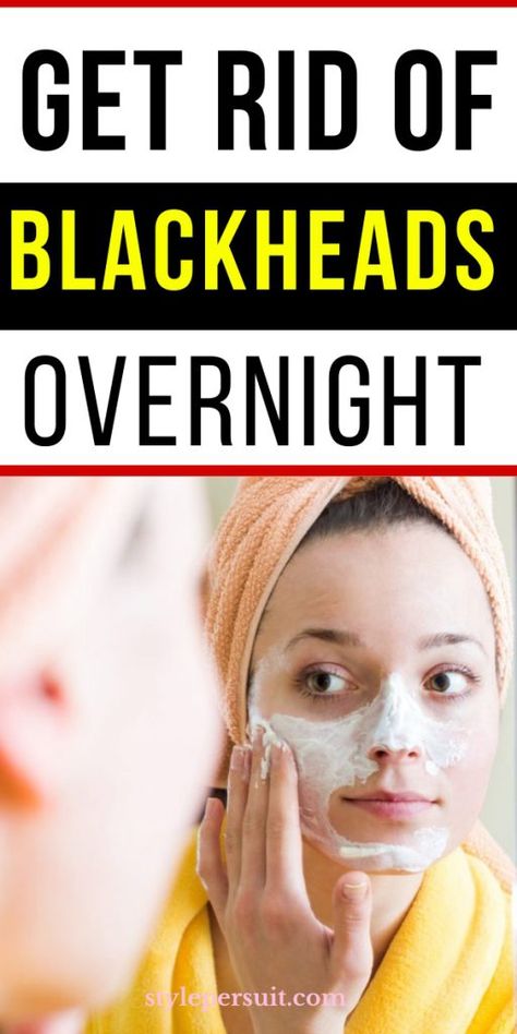 What Are Blackheads, Blackheads On Face, Blackhead Remover Diy, Clear Blackheads, Blackhead Remedies, Blackheads On Nose, Rid Of Blackheads, Clean Blackheads, Blackhead Mask