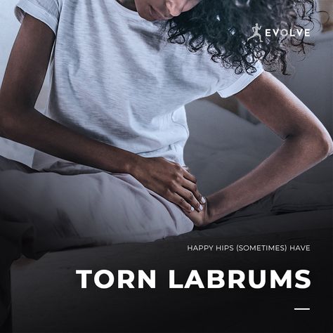 Happy hips (sometimes) have torn labrums! Many people assume the only way to manage a torn labrum is through surgery but many people can live asymptomatically and be very active despite a torn labrum with the help of physical therapy. Call Evolve Physical Therapy in Brooklyn Today! 1-718-258-3300 https://physicaltherapistnyc.wordpress.com/2023/07/31/physical-therapy-for-labral-tears/ #physicaltherapy #sportsPT #sportsphysicaltherapy #DPT #Brooklyn #labraltear Torn Labrum, Sports Physical Therapy, Physical Therapy, The Only Way, Surgery, The Knee, The Help, Brooklyn, Physics