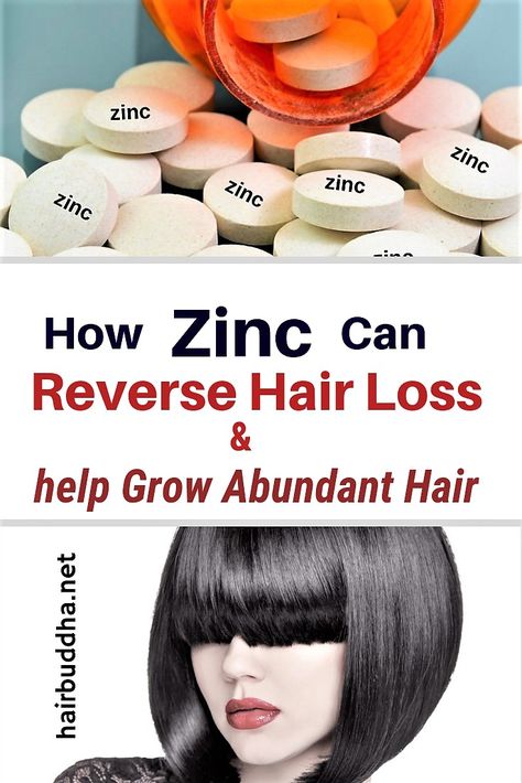 Hair Buddha, Biotin Benefits, Thick Hair Remedies, Female Pattern Baldness, Zinc Deficiency, Male Pattern Baldness, Pattern Baldness, Coconut Oil Hair, Hair Remedies