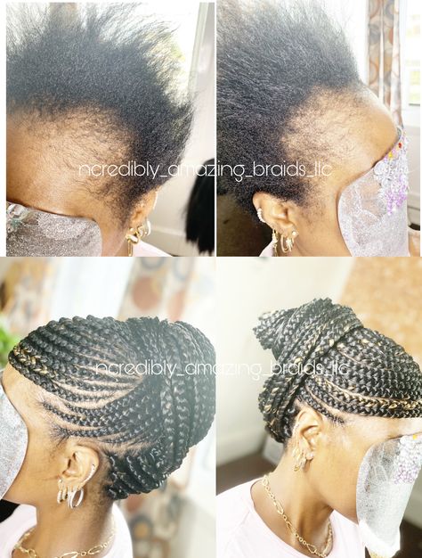 No Hairline Hairstyles For Black Women, Braids That Cover Bald Edges, Braids For Thinning Edges, Braids To Hide Bald Edges, Alopecia Braid Styles, Thinning Edges, Braids Styling, Alopecia Hairstyles, Natural Braided Hairstyles