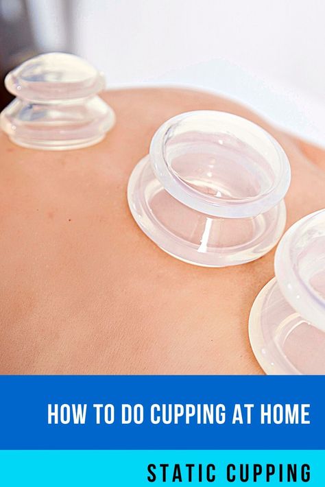 How to Do Cupping at Home, Static Cupping, Basic Cupping Instructions, Cupping Therapy, Cupping, Cupping Set, Massage Cupping, Cupping Massage, Massage Cups, Cupping Warehouse, Cupping Secrets, Myofascial Cupping, Muscle Cupping, Suction Cupping, Soon Video, Silicone Cupping, Cupping At Home, Cupping Therapy, Silicone Cups, Diy Health, Hey There, At Home