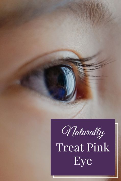 Pink Eye In Toddlers, Pink Eye Remedies, Treating Pink Eye, Crusty Eyes, Natural Pink Eye Remedy, Pinkeye Remedies, Life Hacks Every Girl Should Know, Eye Infections, Baby Eyes