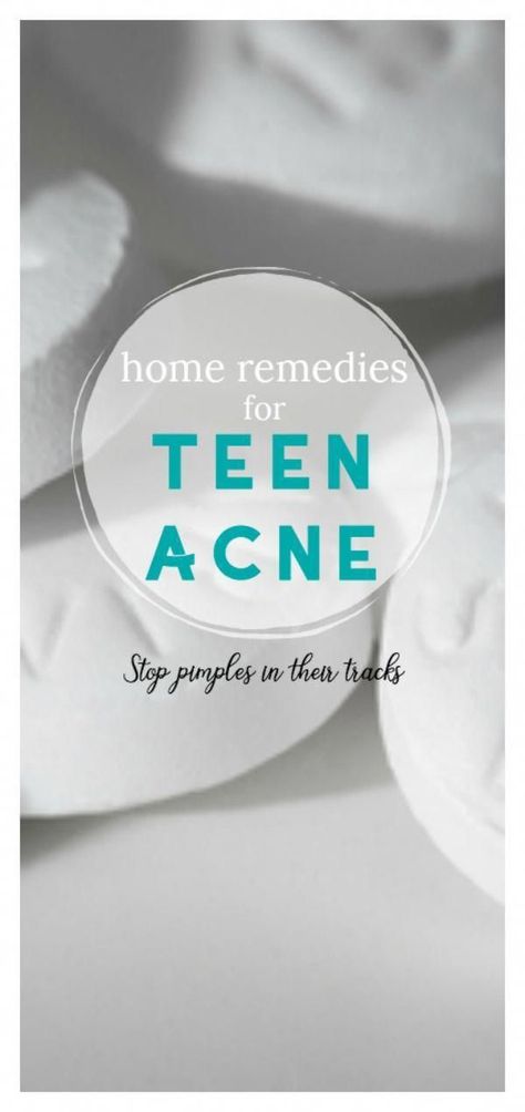 Oily Skin Remedy, How To Reduce Pimples, Bad Acne, Skin Care Routine For 20s, Diy Acne, Natural Acne Remedies, Natural Acne, Home Remedies For Acne, Acne Remedies