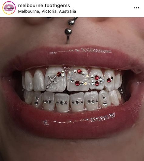 Pretty Teeth, Dental Jewelry, Gold Tooth, Grillz Teeth, Diamond Teeth, Dope Jewelry Accessories, Tooth Gems, Grills Teeth, Tooth Gem