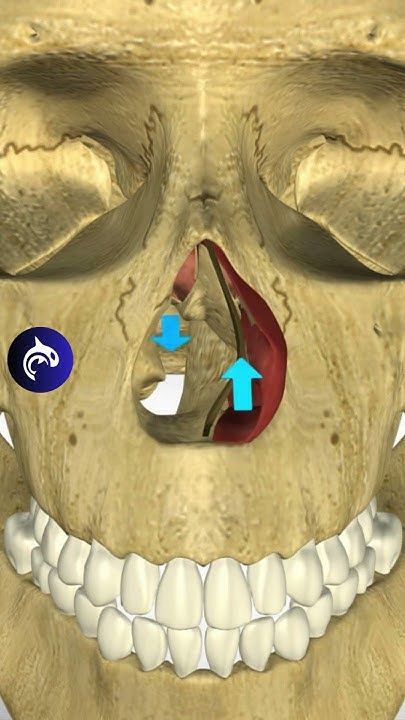 Deviated Septum   A deviated septum occurs when the nasal septum is off-center, affecting nearly 80% of people to some degree. Surgery (septoplasty) can correct severe cases, improving breathing and reducing snoring.   Visualize and understand the Deviated Septum in our 3D animated video below:  YouTube: Nasal Septum, Sleep Health, What Happens When You, 3d Animation, Animated Gif, Surgery, Sleep, Instagram