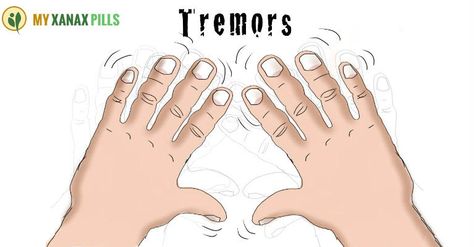 Convalesce Your Tremors with Symmetrel Hand Tremors, Tremors Hand, Essential Tremors, Deep Brain Stimulation, Chronic Fatigue Symptoms, Astrology Remedy, Chronic Fatigue, Chronic Illness, Disease