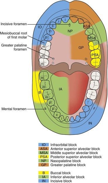 Dental Anesthesia, Dental Assistant School, Dental Hygienist School, Local Anesthesia, Dental Assistant Study, Registered Dental Hygienist, Dental Hygiene Student, Dental Hygiene School, Dentistry Student