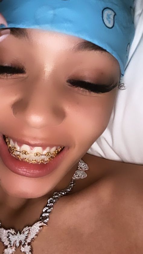 Gold Braces, Cute Braces Colors, Pretty Teeth, Braces Tips, Braces Girls, Cute Braces, Clear Braces, Brace Face, Beautiful Teeth