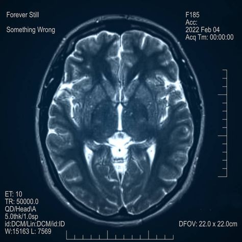 Something Wrong | Forever Still Brain Mri, Palm Springs Pool Party, Brain Scans, Palm Springs Pool, Mri Brain, Anatomy Images, Cat Scan, Brain Images, King's College London