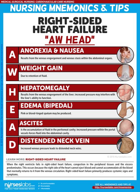 Nursing Mnemonics, Surgical Nursing, Medical Surgical Nursing, Cardiac Nursing, Nursing School Survival, Nursing School Studying, Nursing School Tips, Nursing School Notes, Student Nurse