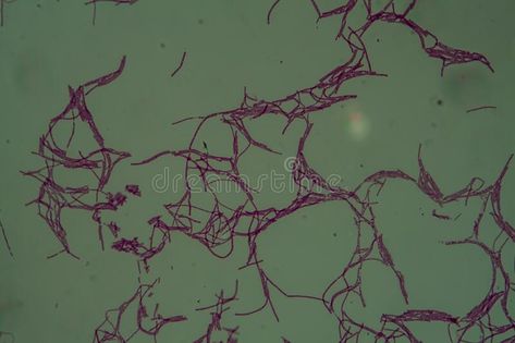 Bacillus Anthracis, Under Microscope, Under The Microscope, Infectious Diseases, Microbiology, Biology, Stock Images, Quick Saves