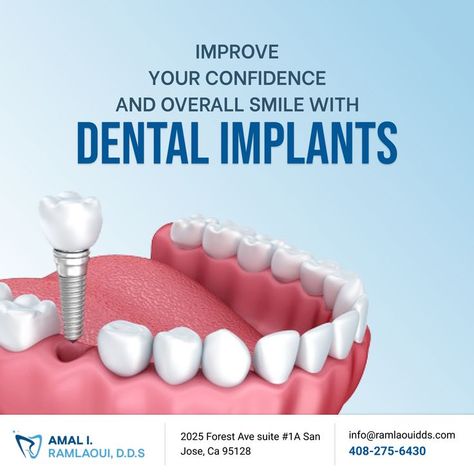 Want to improve your confidence? Improve your confidence and overall smile with Dental Implants. Dental Implant Advertisement, Dental Implants Poster, Dental Implant Poster, Dental Implants Creative Ads, Dental Poster, Dental Post, Dental Ads, Dental Smile, Dental Advertising