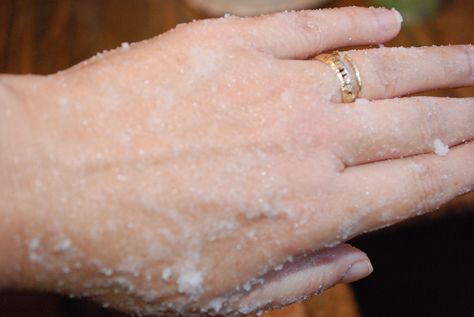 Home recipe for dry, chapped hands. You probably have everything you need already at home. People can't beiieve it when I tell them what to do, but then LOVE IT WHEN IT WORKS! Chapped Hands, Dry Skin Remedies, Diy Kosmetik, Beauty Remedies, Dry Skin Care, Skin Remedies, Beauty Recipe, Diy Skin, Hand Care