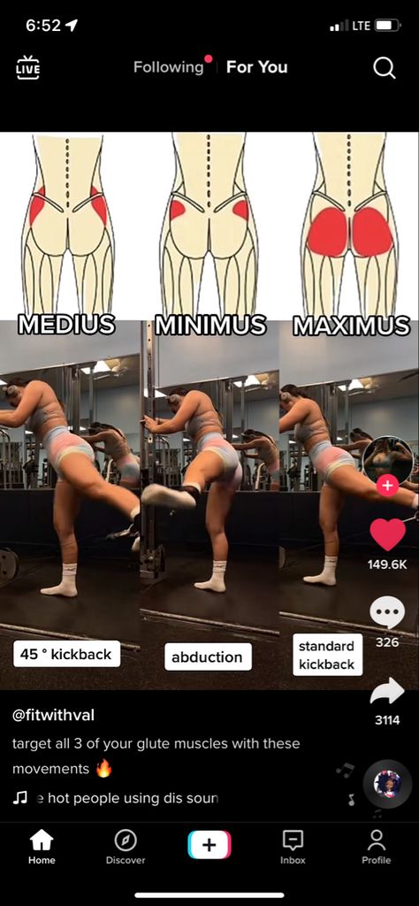 Workouts For Glute Medius, Glutes Anatomy Muscle, Workout For Gluteus Medius, Gluteus Muscles Anatomy, Workout Upper Glutes, Gluteus Exercises Gym, Parts Of The Glute Muscles, Kickback Workout Exercise, Glute Med Kickback