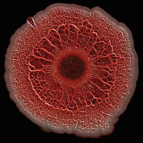 Image Analysis, Human Cells, Pseudomonas Aeruginosa, Bio Art, Leaky Gut, Eye Drops, Microbiology, Science Art, Natural Environment