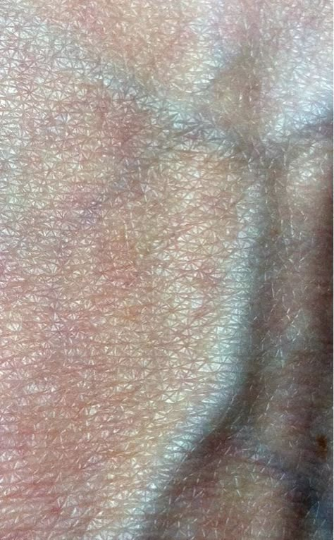 Skin Photography, Texture Photography, Foto Art, Skin Art, New Skin, What’s Going On, Skin Texture, Human Anatomy, Color Textures