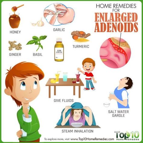 Enlarged Tonsils, Allergies Remedies, Remedies For Chest Congestion, Chest Congestion Remedies, Natural Remedies For Allergies, Top 10 Home Remedies, Congestion Relief, Allergy Remedies, Chest Congestion