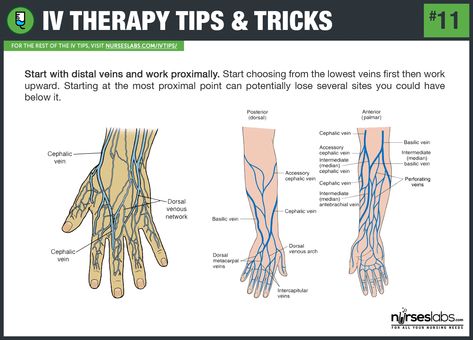 IV therapy tips and tricks: Common venipuncture sites. Iv Injection, Nursing Iv, Iv Insertion, Injection Sites, Iv Line, Nurse Skills, Intravenous Therapy, Nursing School Survival, Nursing School Studying