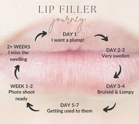 Lip Filler Quotes Sayings, Aesthetic Injector Instagram, Botox Posts For Instagram, Injection Nurse, Nurse Instagram, Dermal Fillers Lips, Med Spa Marketing, Cosmetic Fillers, Esthetician Quotes