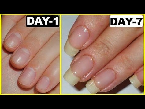 Grow Nails Fast, Akordy Na Ukulele, Make Nails Grow, Grow Long Nails, Nail Growth Tips, Grow Nails Faster, Nail Hacks, Nagel Tips, How To Grow Nails