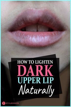 How To Lighten Dark Upper Lips Naturally #beauty #tips Dark Upper Lip, Upper Lips, Natural Hair Mask, Boost Hair Growth, Get Rid Of Blackheads, Dark Lips, Upper Lip, Face Scrub, Pink Lips