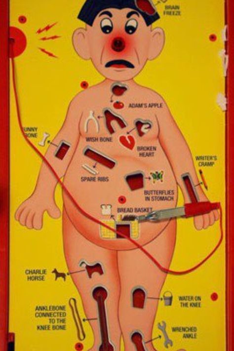 Operation game I loved this game but didn't have a steady hand that was needed to play it well Operation Board Game, Operation Game, Fun Board Games, Oldies But Goodies, Childhood Toys, Retro Toys, Great Memories, Sweet Memories, The Good Old Days