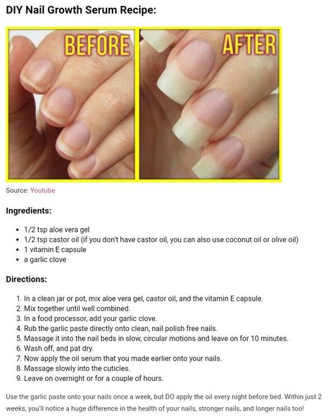 Nail growth Nail Growth Tips, Nagellack Trends, Nagel Tips, How To Grow Nails, Nail Growth, Healthy Nails, Beauty Skin Care Routine, Aloe Vera Gel, Body Skin Care