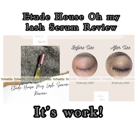 Eyelash serum review. Skincare, lash care. Grow natural lash in just 2 weeks. Eyelashes Serum, My Lash Serum, Eye Lash Serum, Makeup Types, Eyelash Serum, Lash Serum, Skincare Review, Etude House, Oh My