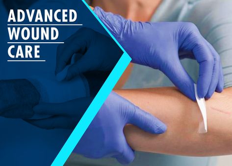 The Top key vendors in  Advanced Wound Care Market include are   Smith & Nephew, B.Braun, ConvaTec  Group, Integra Lifesciences, 3M, Cardinal Heatch, Medtronic, MPM Medical, Paul Hartmann, MiMedx Group.   Trend Insight Report - Request  PDF Sample Copy of  Advanced Wound Care Market at https://www.marketindustryreports.com/pdf/1 Proteolytic Enzymes, Wound Care Dressings, Granulation Tissue, Leg Ulcers, Hyperbaric Oxygen Therapy, Pressure Ulcer, Wound Dressing, Wound Care, Research Studies